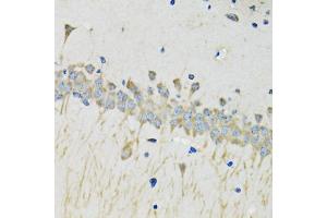 Immunohistochemistry of paraffin-embedded mouse brain using SERPINA4 antibody (ABIN5975715) at dilution of 1/100 (40x lens). (SERPINA4 anticorps)