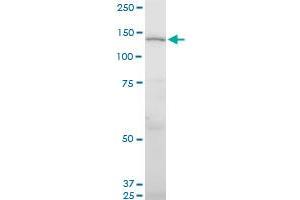 UNC13D monoclonal antibody (M05), clone 2C7. (UNC13D anticorps  (AA 2-100))