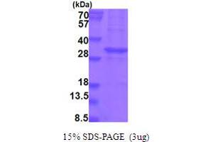 SDS-PAGE (SDS) image for Kallikrein-Related Peptidase 13 (KLK13) (AA 17-277) protein (His tag) (ABIN6387541)
