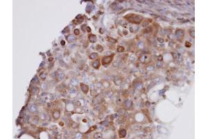 IHC-P Image Immunohistochemical analysis of paraffin-embedded H441 xenograft, using GPX7 , antibody at 1:100 dilution.