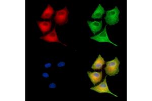 ABIN7095232 and ABIN7099289 staining  cells by IF/ICC. (PFAS anticorps)