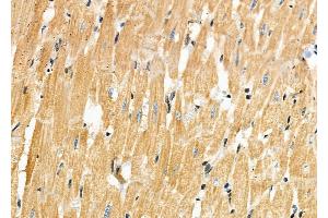 ABIN6257537 and ABIN6273542 at 1/100 staining Rat heart tissue by IHC-P.