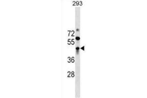Western blot analysis in 293 cell line lysates (35 ug/ml) using. (ZBTB32 anticorps  (AA 96-125) (APC))