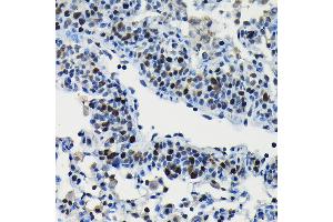 Immunohistochemistry of paraffin-embedded rat lung using A Rabbit pAb (ABIN6131196, ABIN6137102, ABIN6137103 and ABIN6223591) at dilution of 1:100 (40x lens).