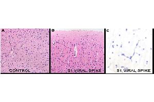 IHC Results in mice after tail vein injection of spike S1 subunit. (SARS-CoV-2 Spike S1 anticorps)