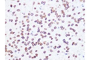 Immunohistochemistry of paraffin-embedded rat brain using Lamin B2 Rabbit mAb (ABIN1679310, ABIN3019324, ABIN3019325 and ABIN7101750) at dilution of 1:100 (40x lens).