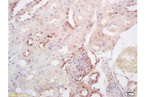 Formalin-fixed and paraffin embedded rat kidney labeled with Rabbit Anti SULT2A1 Polyclonal Antibody, Unconjugated (ABIN712916) at 1:200 followed by conjugation to the secondary antibody and DAB staining