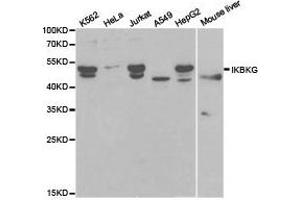 Western Blotting (WB) image for anti-Inhibitor of kappa Light Polypeptide Gene Enhancer in B-Cells, Kinase gamma (IKBKG) antibody (ABIN1873181)