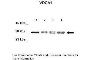 Lanes:   Lane 1: 50ug HeLa lysate Lane 2: 50ug 293T lysate Lane 3: 50ug K562 lysate Lane 4: 50ug MDA-MB-231 lysate  Primary Antibody Dilution:   1:1000  Secondary Antibody:   Anti-rabbit-HRP  Secondary Antibody Dilution:   1:1000  Gene Name:   VDAC1  Submitted by:   David Colecchia, Ph.