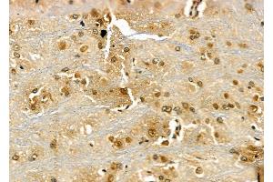 ABIN6266313 and ABIN6277430 at 1/100 staining Rat brain tissue by IHC-P. (RAD52 anticorps  (Internal Region))