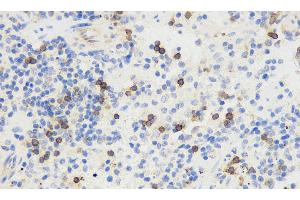 Immunohistochemistry analysis of paraffin-embedded mouse spleen using THY1 Polyclonal Antibody at dilution of 1:500. (CD90 anticorps)