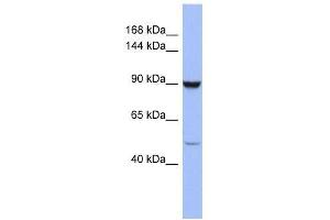 ZFP28 antibody used at 0. (ZFP28 anticorps  (Middle Region))