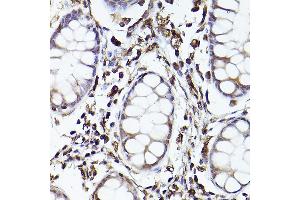 Immunohistochemistry of paraffin-embedded human colon using TLR8 Rabbit pAb (ABIN3022014, ABIN3022015, ABIN3022016, ABIN1513616 and ABIN6218568) at dilution of 1:150 (40x lens).