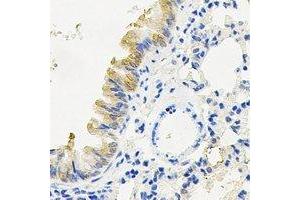 Immunohistochemical analysis of RANBP5 staining in mouse lung formalin fixed paraffin embedded tissue section.