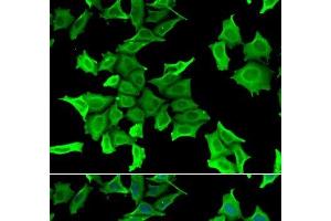 Immunofluorescence analysis of HeLa cells using SPINT2 Polyclonal Antibody (SPINT2 anticorps)
