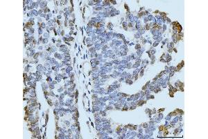 IHC analysis of ARL6IP6 using anti-ARL6IP6 antibody (ABIN7603020).