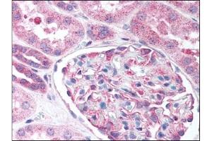 Image no. 1 for anti-Nestin (NES) (AA 1484-1500) antibody (ABIN303340) (Nestin anticorps  (AA 1484-1500))