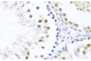 Immunohistochemistry of paraffin-embedded Rat testis using DDX46 Polyclonal Antibody at dilution of 1:100 (40x lens). (DDX46 anticorps)