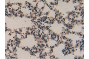 Detection of MMP12 in Mouse Lung Tissue using Polyclonal Antibody to Matrix Metalloproteinase 12 (MMP12)