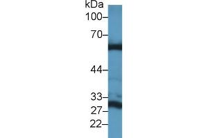 Detection of GLS2 in Mouse Liver lysate using Polyclonal Antibody to Glutaminase 2 (GLS2)