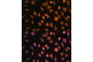 anti-ELOVL Fatty Acid Elongase 4 (ELOVL4) (AA 1-100) antibody