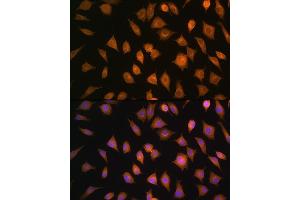 Immunofluorescence analysis of L929 cells using ELOVL4 Rabbit pAb (ABIN1679709, ABIN3017923, ABIN3017924 and ABIN6220305) at dilution of 1:100. (ELOVL4 anticorps  (AA 1-100))
