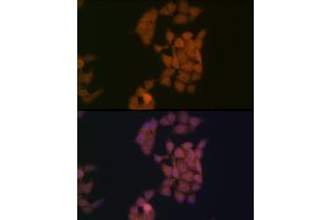 anti-Zinc Finger and BTB Domain Containing 33 (ZBTB33) antibody