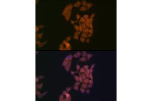 Immunofluorescence analysis of HeLa cells using Kaiso/ZBTB33 Rabbit mAb (ABIN7271437) at dilution of 1:100 (40x lens). (ZBTB33 anticorps)