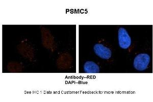 Sample Type :  Human brain stem cells  Primary Antibody Dilution :  1:500  Secondary Antibody :  Goat anti-rabbit Alexa-Fluor 594  Secondary Antibody Dilution :  1:1000  Color/Signal Descriptions :  PSMC5: Red DAPI:Blue  Gene Name :  PSMC5  Submitted by :  Dr. (PSMC5 anticorps  (C-Term))