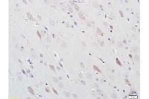 Paraformaldehyde-fixed, paraffin embedded rat brain, Antigen retrieval by boiling in sodium citrate buffer (pH6) for 15min, Block endogenous peroxidase by 3% hydrogen peroxide for 30 minutes, Blocking buffer (normal goat serum) at 37°C for 20min, Antibody incubation with Nitrotyrosine Polyclonal Antibody, Unconjugated  at 1:200 overnight at 4°C, followed by a conjugated secondary and DAB staining.