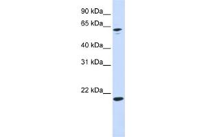 WB Suggested Anti-APRT Antibody Titration: 0. (APRT anticorps  (N-Term))