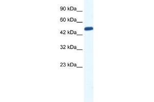 WB Suggested Anti-ZNF239 Antibody Titration:  0. (ZNF239 anticorps  (N-Term))