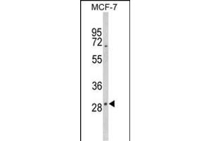 Western blot analysis of DIO2 Antibody (Center) (ABIN652664 and ABIN2842445) in MCF-7 cell line lysates (35 μg/lane).