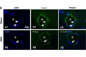 The molecules involved in IPAD impairment after SAH.