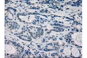 Immunohistochemical staining of paraffin-embedded endometrium tissue using anti-FRKmouse monoclonal antibody. (FRK anticorps)