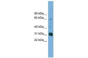 CCDC127 antibody used at 1 ug/ml to detect target protein. (CCDC127 anticorps  (N-Term))