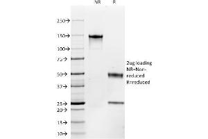 SDS-PAGE Analysis Purified CD117 Mouse Monoclonal Antibody (C117/370). (KIT anticorps)