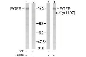 Image no. 1 for anti-Epidermal Growth Factor Receptor (EGFR) (Tyr1197) antibody (ABIN197463) (EGFR anticorps  (Tyr1197))