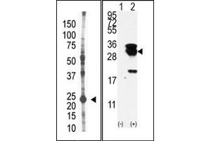 Image no. 1 for anti-Ubiquitin-Conjugating Enzyme E2S (UBE2S) (N-Term) antibody (ABIN357497) (UBE2S anticorps  (N-Term))