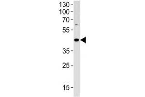 ADA antibody western blot analysis in HL-60 lysate