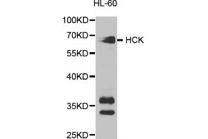 Western blot analysis of extracts of HL-60 cells, using HCK antibody. (HCK anticorps)