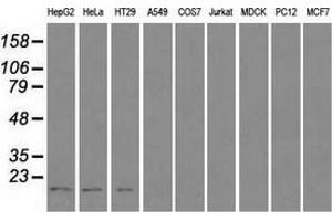 Western blot analysis of extracts (35 µg) from 9 different cell lines by using anti-CTAG1B monoclonal antibody. (CTAG1B anticorps)