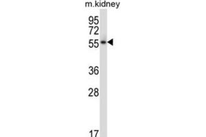 Western Blotting (WB) image for anti-Polo-Like Kinase 5 (PLK5) antibody (ABIN2997865) (PLK5 anticorps)