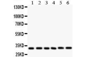 Anti- CASP3 antibody, Western blotting All lanes: Anti CASP3  at 0. (Caspase 3 anticorps  (C-Term))