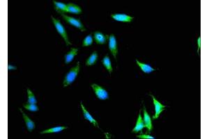 Immunofluorescent analysis of Hela cells using ABIN7156472 at dilution of 1: 100 and Alexa Fluor 488-congugated AffiniPure Goat Anti-Rabbit IgG(H+L)