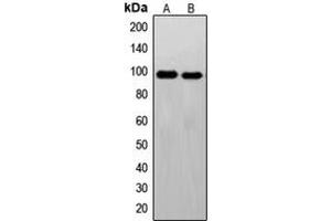 Western blot analysis of c-FER expression in Jurkat (A), HeLa (B) whole cell lysates. (FER anticorps  (C-Term))