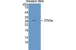 Western blot analysis of the recombinant protein. (EBI3 anticorps  (AA 19-228))