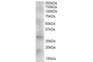 Western Blotting (WB) image for anti-Dickkopf 2 Homolog (DKK2) (C-Term) antibody (ABIN2465604) (DKK2 anticorps  (C-Term))