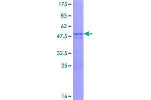 Image no. 1 for Von Hippel-Lindau Tumor Suppressor, E3 Ubiquitin Protein Ligase (VHL) (AA 1-172) protein (GST tag) (ABIN1325000)