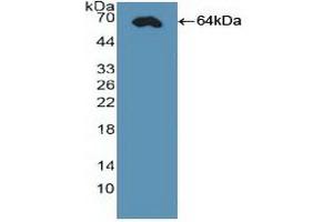 Detection of Recombinant CDX2, Human using Polyclonal Antibody to Caudal Type Homeobox 2 (CDX2)